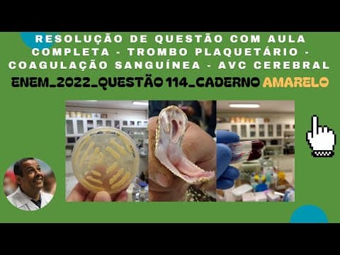 Thumbnail da aula: ENEM 2022 QUESTÃO 114  CADERNO AMARELO_TROMBO PLAQUETÁRIO - COAGULAÇÃO SANGUÍNEA - AVC CEREBRAL