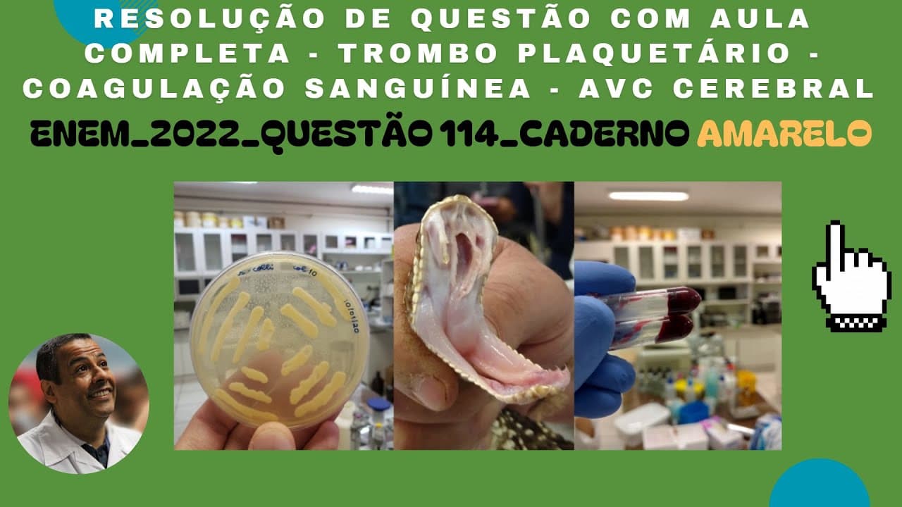 Thumbnail: ENEM 2022 QUESTÃO 114  CADERNO AMARELO_TROMBO PLAQUETÁRIO - COAGULAÇÃO SANGUÍNEA - AVC CEREBRAL