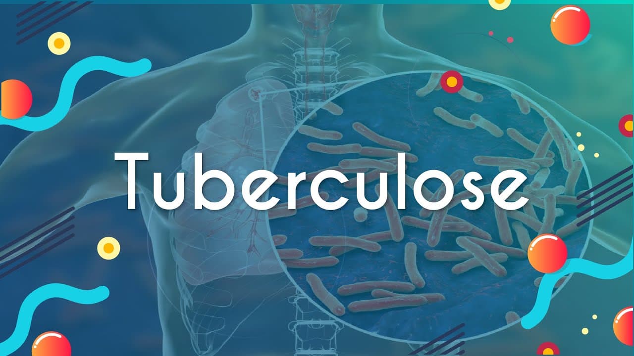 Thumbnail: Tuberculose - Brasil Escola