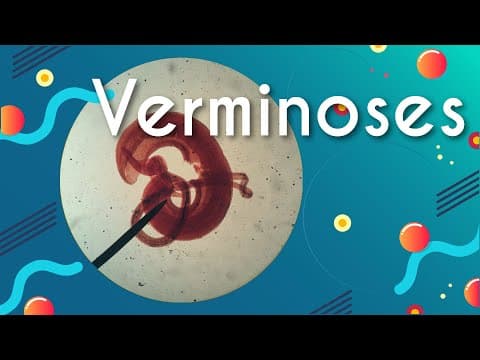 Thumbnail da aula: Verminoses: doenças causadas por vermes - Brasil Escola