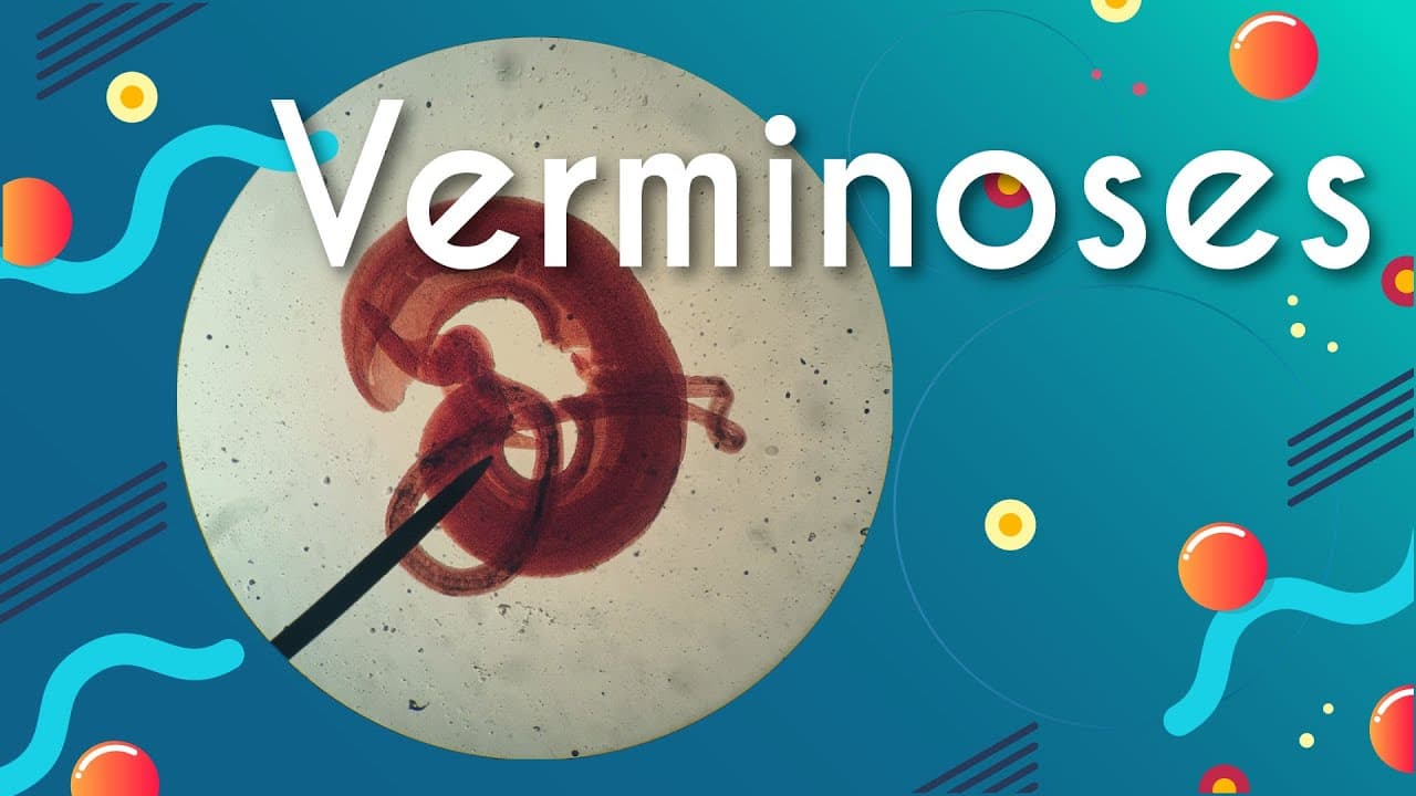 Thumbnail: Verminoses: doenças causadas por vermes - Brasil Escola
