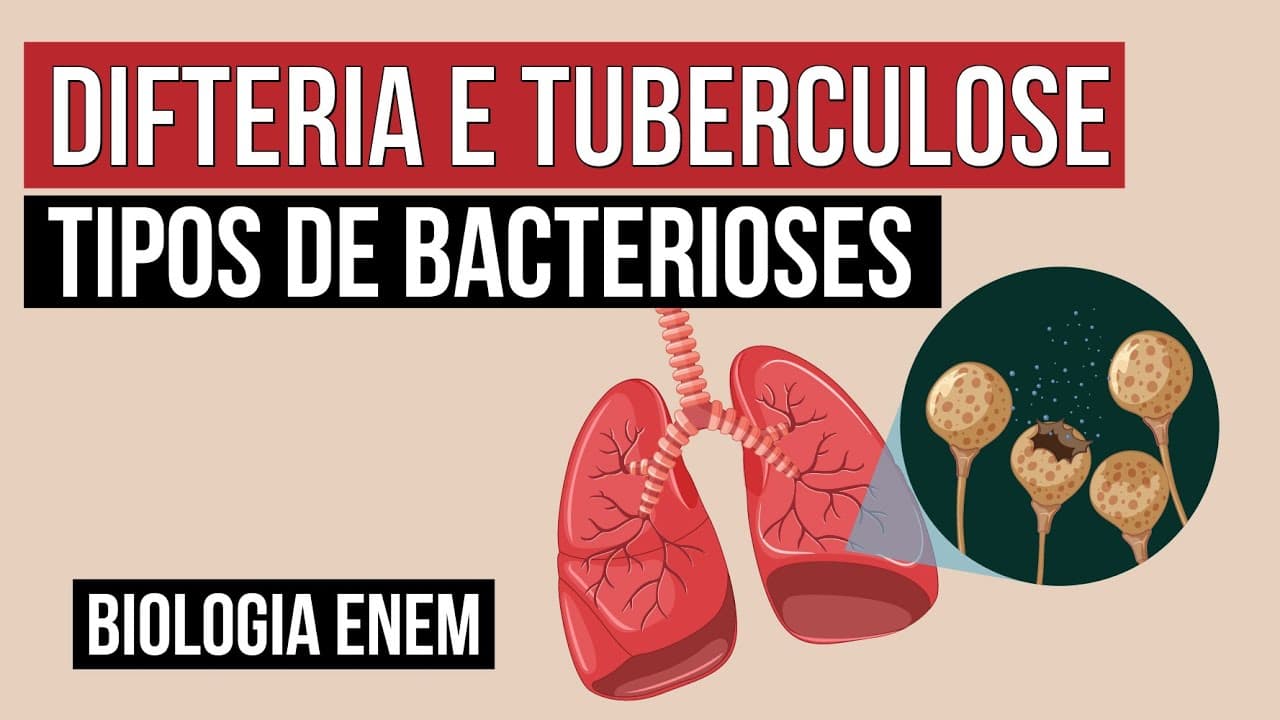 Thumbnail: DIFTERIA E TUBERCULOSE: tipos de bacterioses | Biologia para o Enem | Cláudia de Souza Aguiar