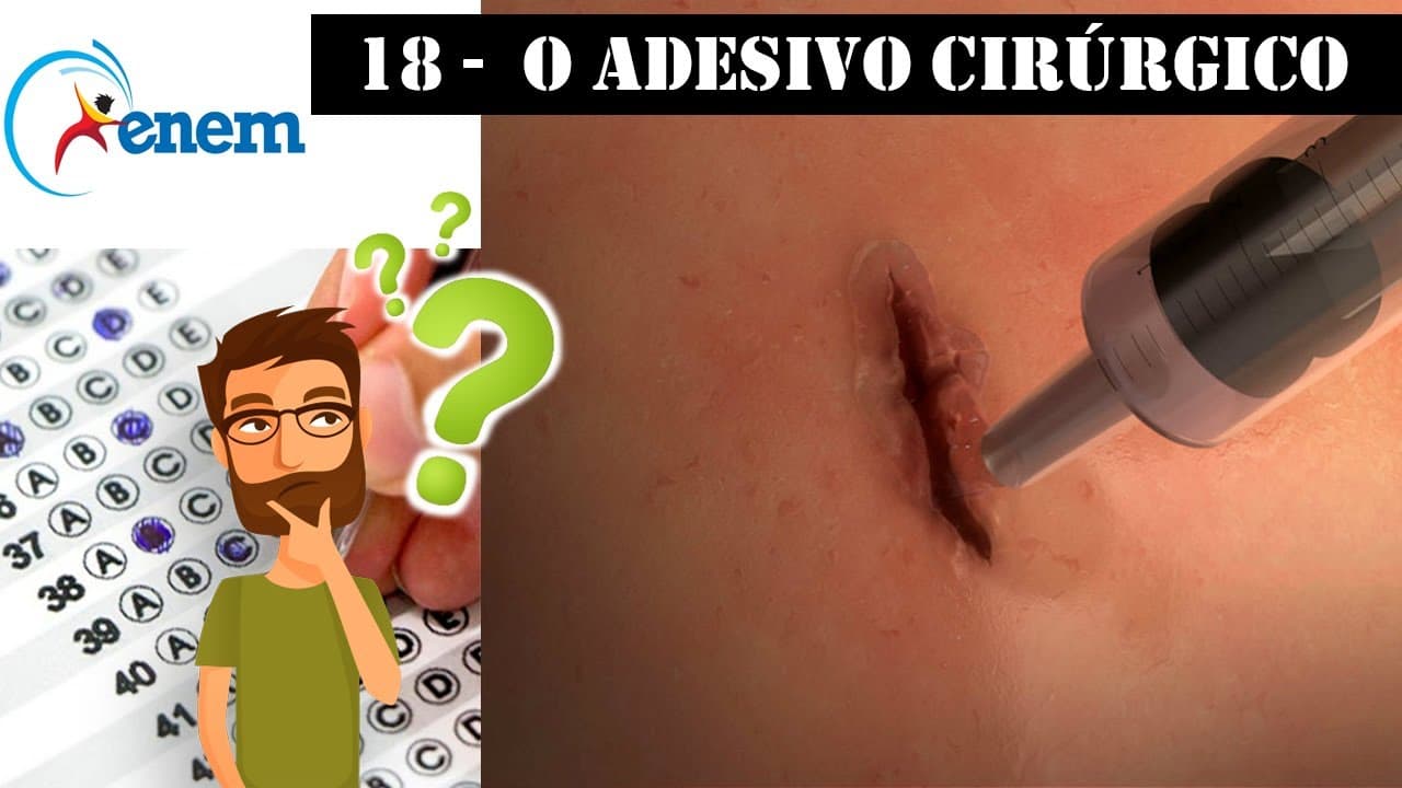 Thumbnail: Questão 18 - O ADESIVO CIRÚRGICO  - Biologia no ENEM (2009:1)