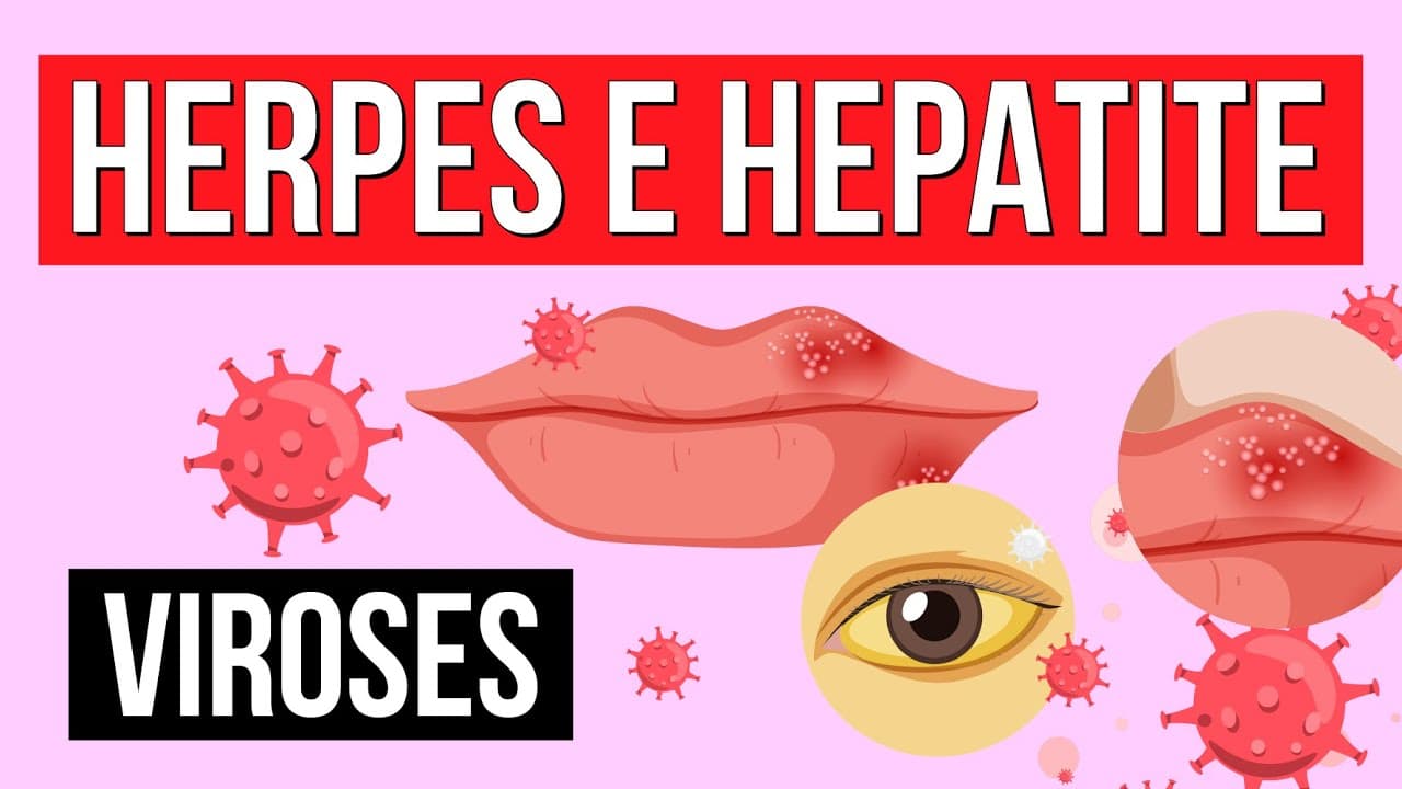 Thumbnail: HERPES E HEPATITE: tipos de viroses | Resumo de Biologia para o Enem | Cláudia de Souza Aguiar