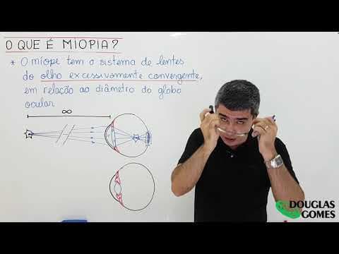 Thumbnail da aula: Miopia - Defeitos de visão
