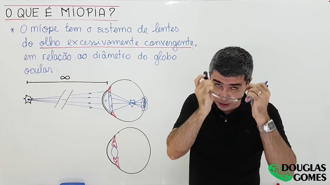 Thumbnail: Miopia - Defeitos de visão