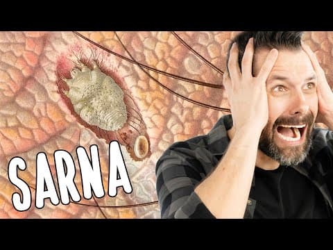 Thumbnail da aula: SARNA HUMANA - Escabiose - Uma coceira insuportável | Biologia com Samuel Cunha