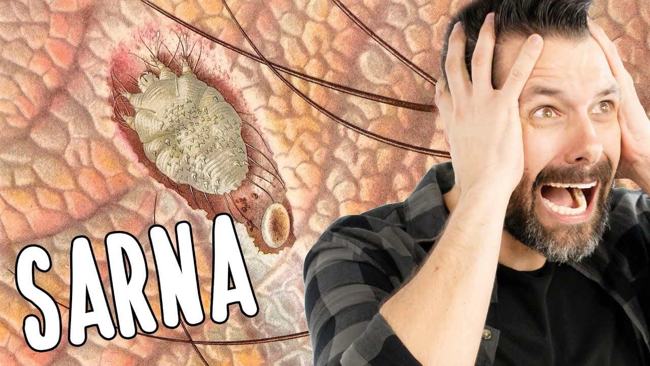 Thumbnail: SARNA HUMANA - Escabiose - Uma coceira insuportável | Biologia com Samuel Cunha