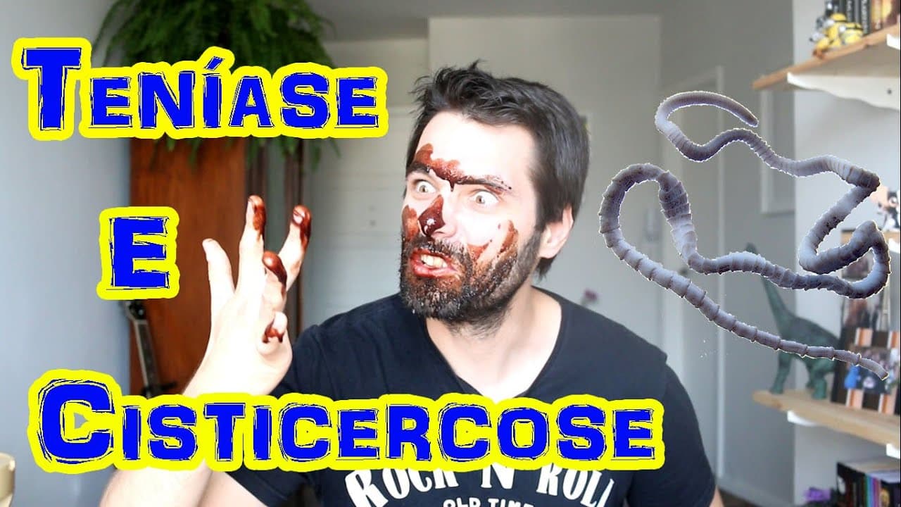 Thumbnail: Teníase (Solitária) e Cisticercose - Parasitologia