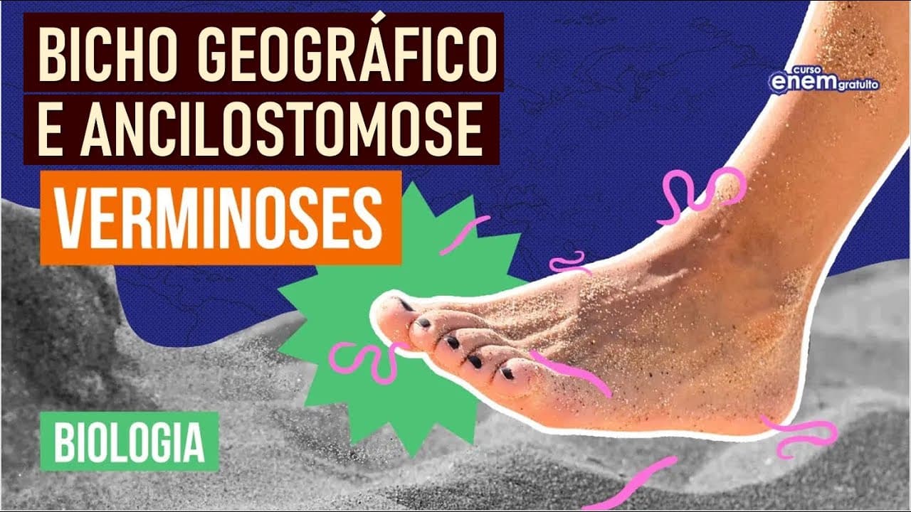 Thumbnail: ANCILOSTOMOSE E BICHO GEOGRÁFICO: tipos de verminoses | Resumo de Biologia Enem | Cláudia Aguiar