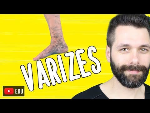 Thumbnail da aula: VARIZES - O que são, causas e o que fazer? Visão biológica | Biologia com Samuel Cunha