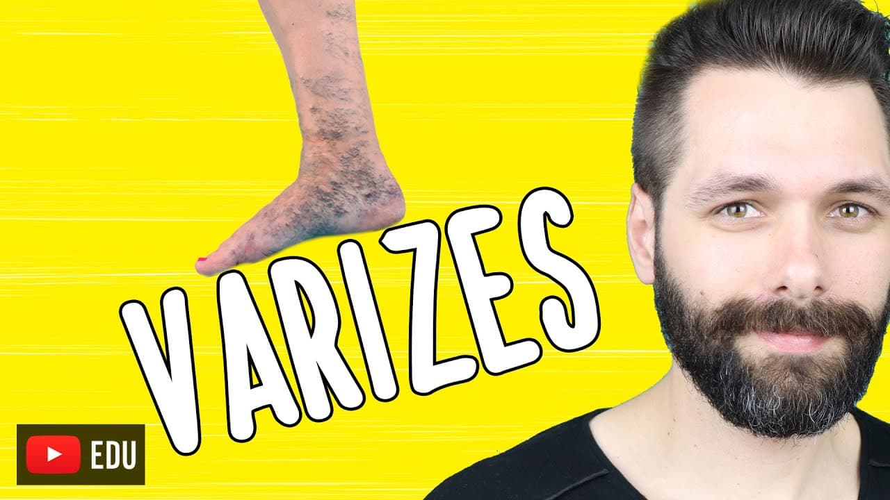Thumbnail: VARIZES - O que são, causas e o que fazer? Visão biológica | Biologia com Samuel Cunha