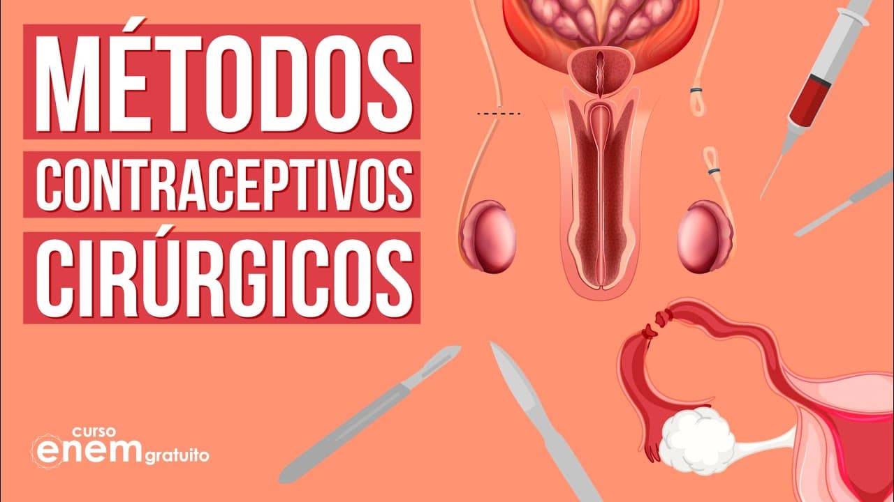 Thumbnail: VEJA COMO SÃO OS MÉTODOS CONTRACEPTIVOS CIRÚRGICOS | Resumo de Biologia para o Enem