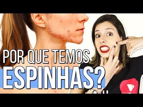 Thumbnail da aula: ACNE: CAUSAS E COMO RESOLVER | Prof. Camila Cavalieri