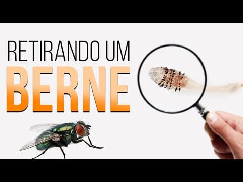 Thumbnail da aula: Retirando um BERNE | Professor Guilherme