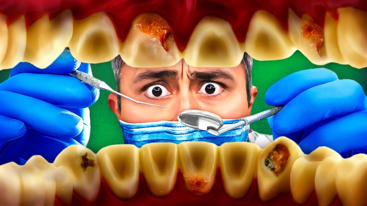 Thumbnail: O que causa as CÁRIES?