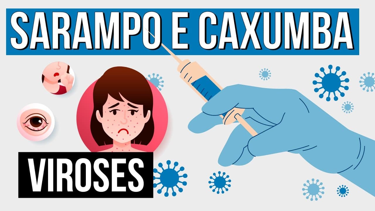 Thumbnail: SARAMPO E CAXUMBA: tipos de viroses | Resumo de Biologia para o Enem | Cláudia de Souza Aguiar