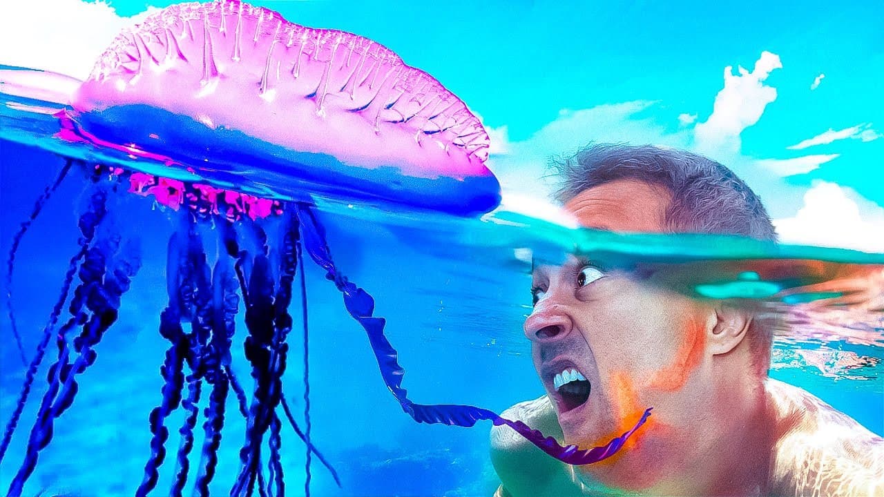 Thumbnail: Queimadura de água-viva? Veja o que fazer!