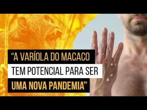 Thumbnail da aula: Varíola do macaco (MPox ou Monkeypox) - Como pega? (e tudo mais)