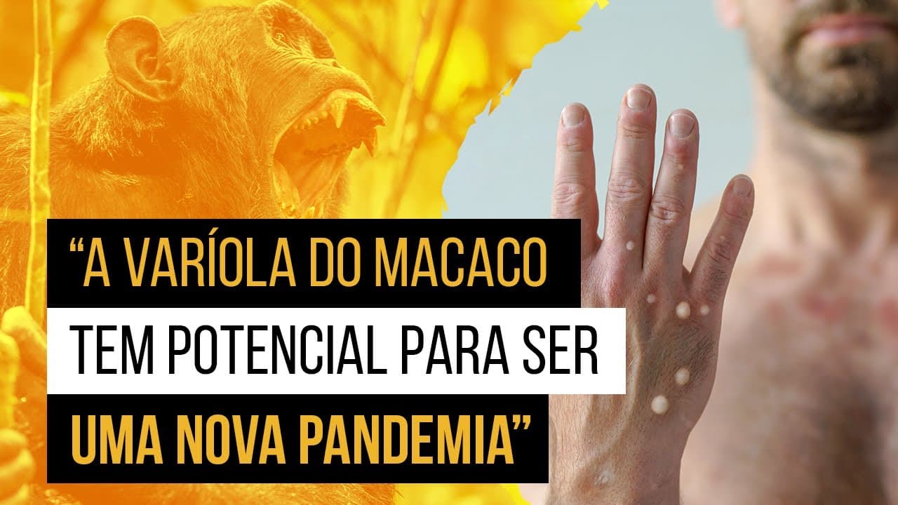 Thumbnail: Varíola do macaco (MPox ou Monkeypox) - Como pega? (e tudo mais)