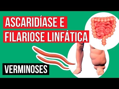 Thumbnail da aula: Lombrigas e Elefantíase: tipos de verminoses | Resumo de Biologia para o Enem | Cláudia