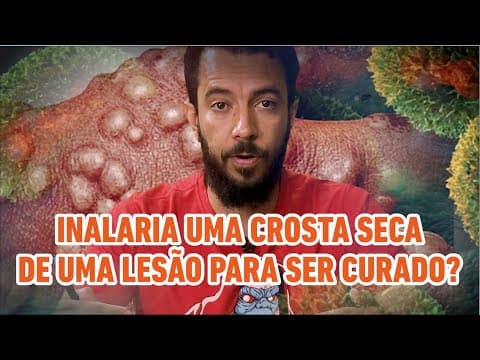 Thumbnail da aula: Inalaria a crosta seca de uma lesão para evitar uma doença? História da vacina