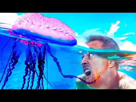 Thumbnail da aula: Queimadura de água-viva? Veja o que fazer!